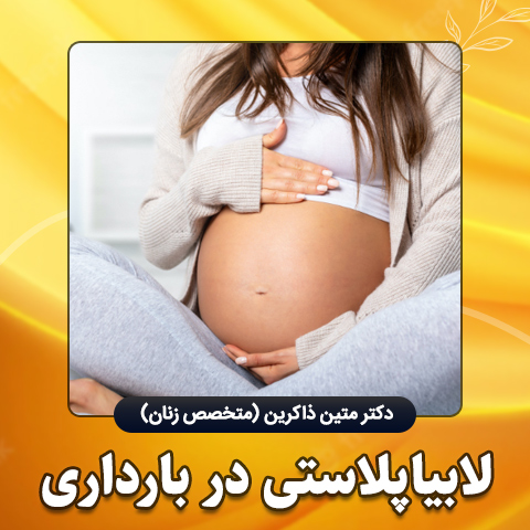 لابیاپلاستی-در-بارداری