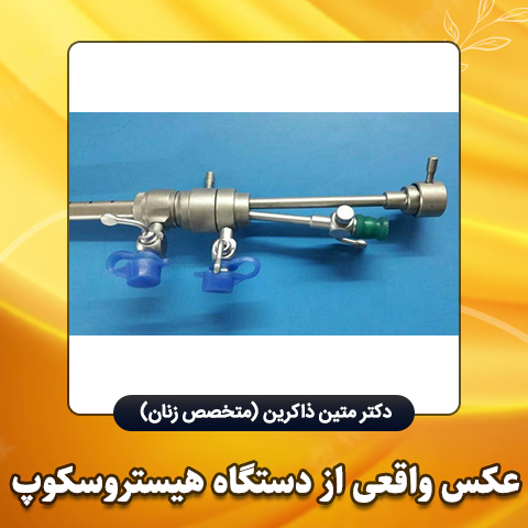 عکس-واقعی-از-دستگاه-هیستروسکوپ