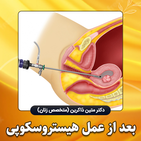 بعد-از-عمل-هیستروسکوپی