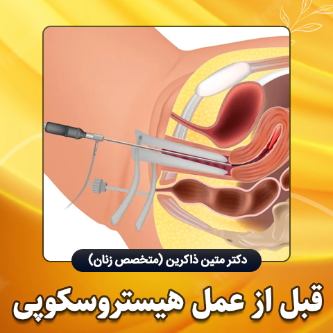 قبل-از-عمل-هیستروسکوپی